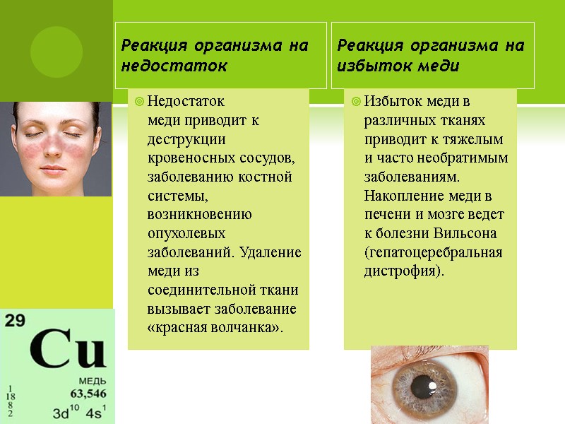 Реакция организма на недостаток  Недостаток меди приводит к деструкции кровеносных сосудов, заболеванию костной